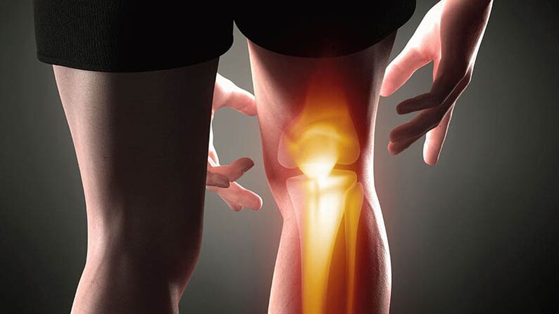 The knee joint is joint joint